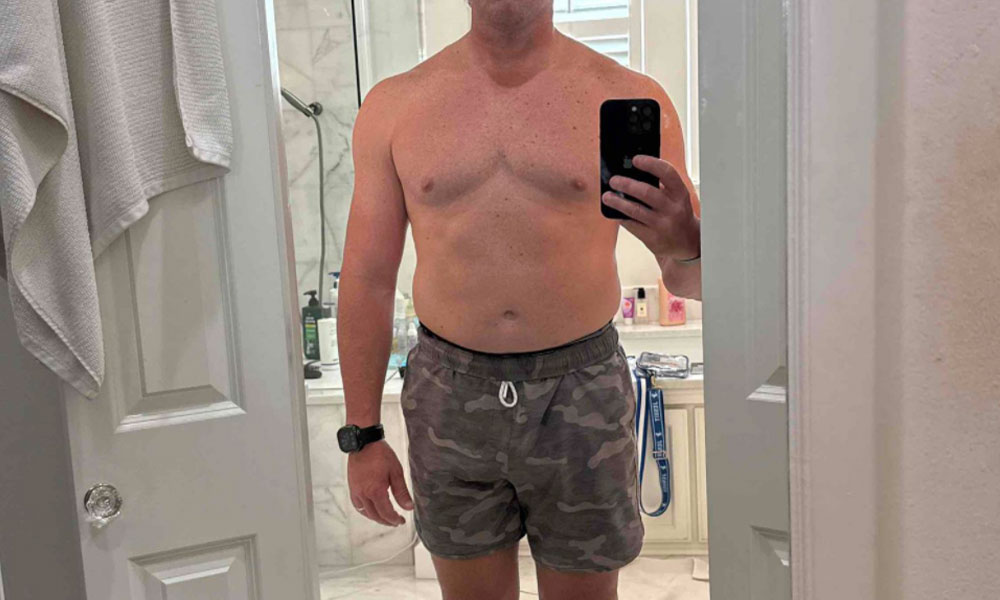 Before Transformation 4